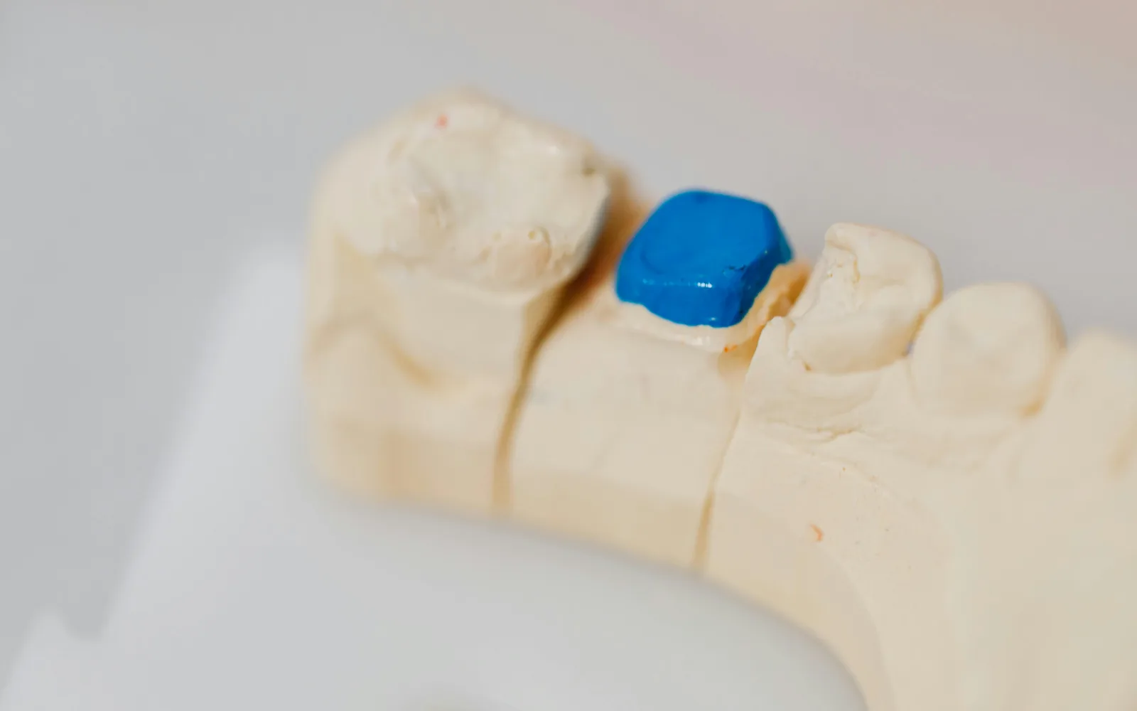 Dental crown model.