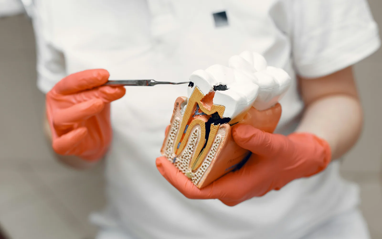 Root canal model.